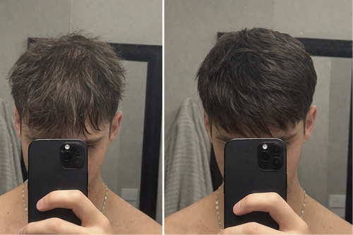 Anti-Schuppen Scalp Scrub