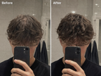 Anti-Schuppen Scalp Scrub
