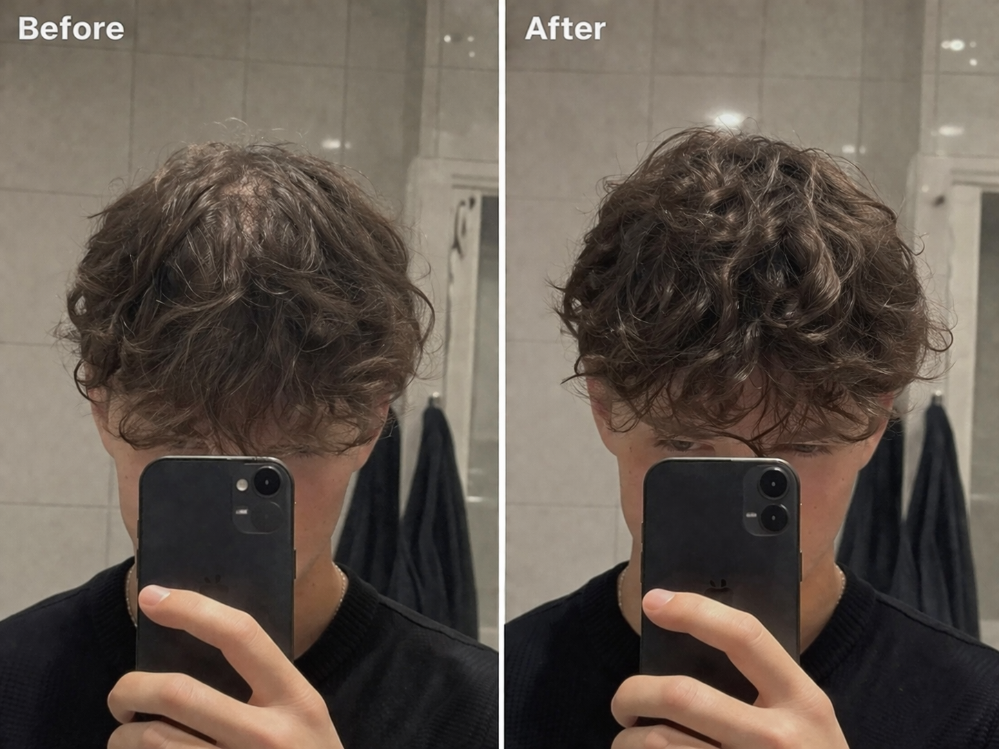 Anti-Schuppen Scalp Scrub