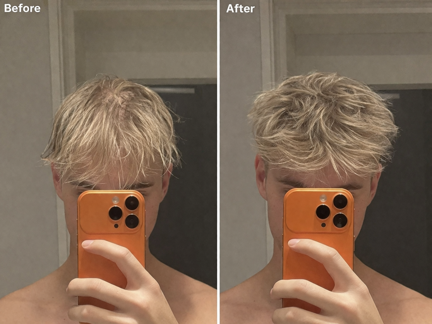 Anti-Schuppen Scalp Scrub